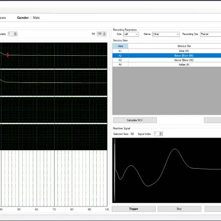 Data Acquisition UI