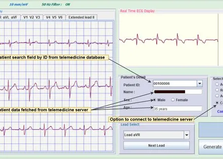 ECG UI for Telemedicine