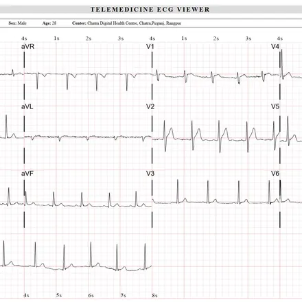 Web ECG Viewer